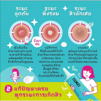 Lightweight anti-acne cream with ceramide complex