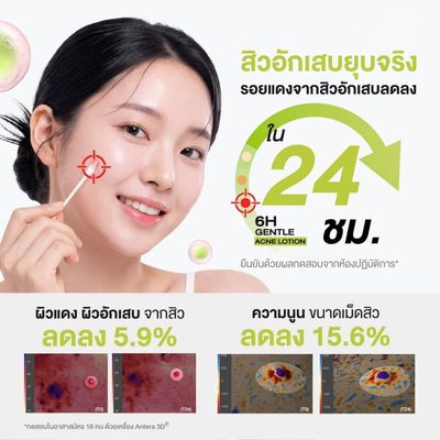 Dr.PONG Fast Acting Redness Reducing Acne Lotion