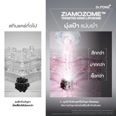 Dr.PONG G89 ZIAMOZOME technology