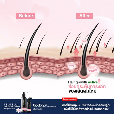 Dr.PONG Tsutsuji Hair Rejuvenating Serum for scalp care