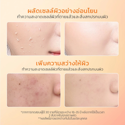 Before and after skin smoothness with Glad2Glow peeling gel
