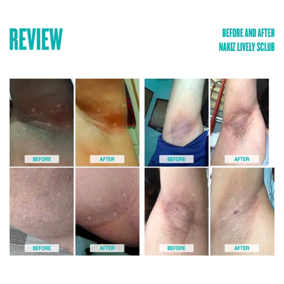 Underarm scrub before and after