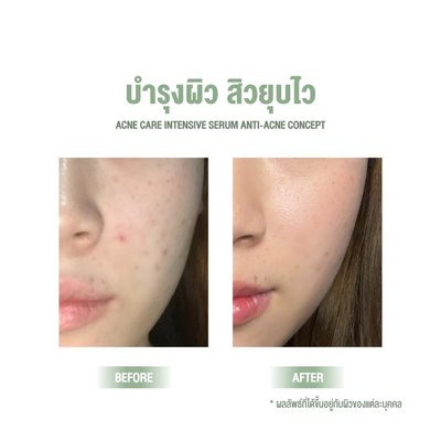 Quick-absorbing serum for fresh skin