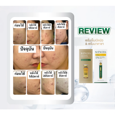 Natacha R-EX2 Ampoule serum