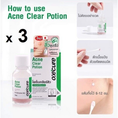 Reduce acne and dark spots with Oxe'cure