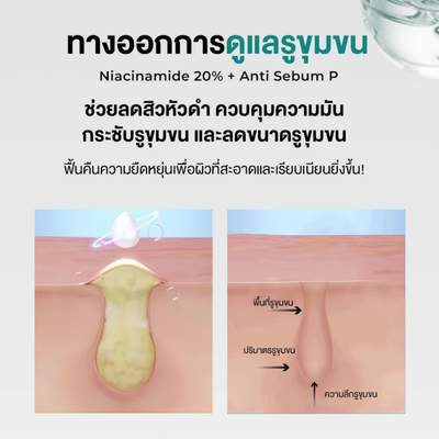 PORECENT Tightening Solution 40ml