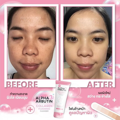 Smooth brighter skin after Precious Skin Cleanser