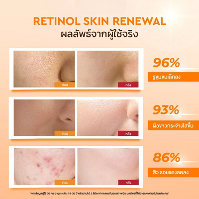 Skin balancing retinol night moisturizer