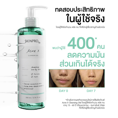 SKINPRO Acne X gel dispensed on hand