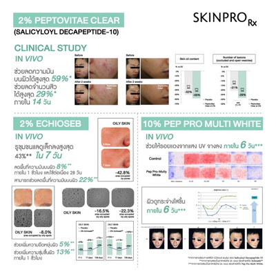 SKINPRO Acne X Serum dropper on hand