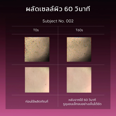 SKINTIFIC 4-Acids + 1 Enzyme Peeling Solution for radiant skin