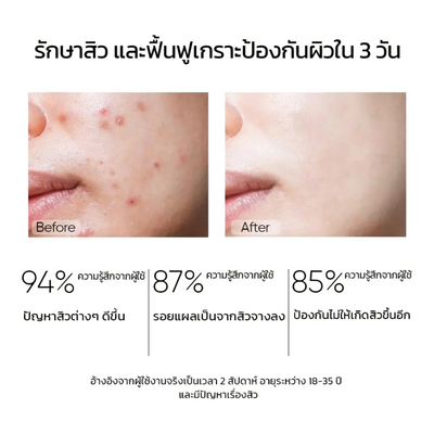 SKINTIFIC Salicylic Acid Daily Serum