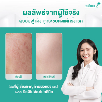 Glycerin benefit in Smooth E cleanser for moisture balance