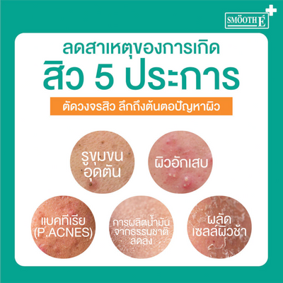 Smooth E Zinc PCA Oil Control Serum