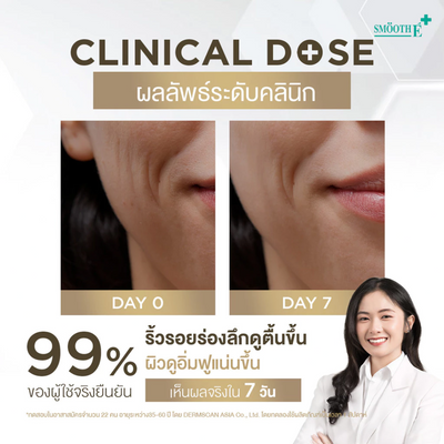Smooth E Retinol+ Serum 30g Thailand