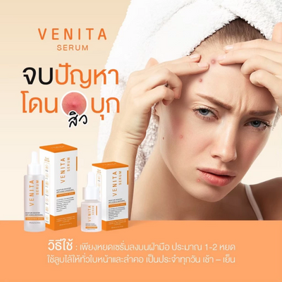 Applying Venita Anti-Acne Whitening Serum on face
