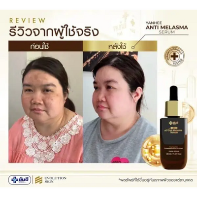 Before and after serum use