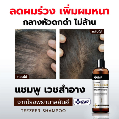 Before and after result of Yanhee shampoo