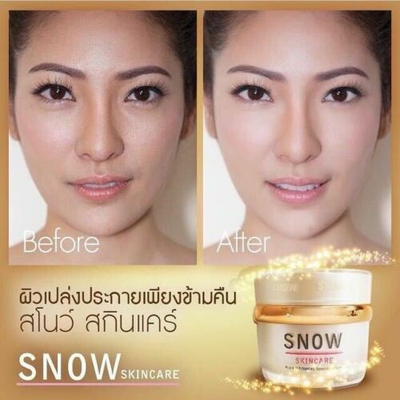 Intensive skin brightening and whitening treatment