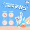 Yanhee Acne Cream for clogged pores and smoother skin