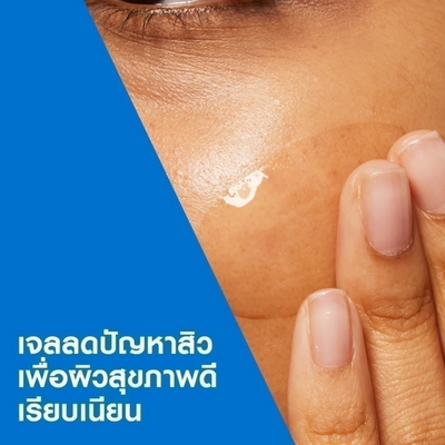 Refined skin results with CeraVe blemish gel