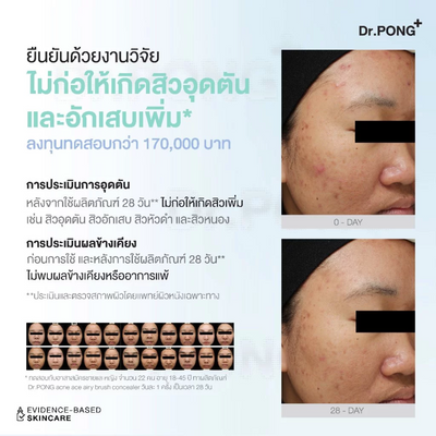 Longwear Acne Ace Concealer