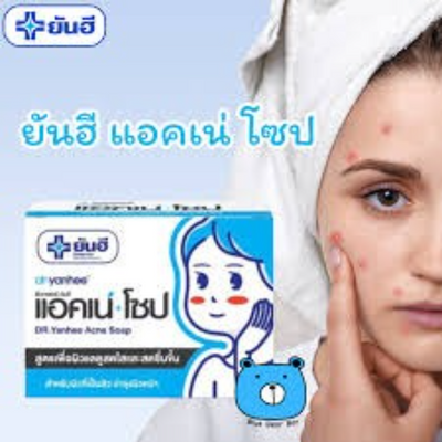 Acne treatment soap for face and body with natural extracts