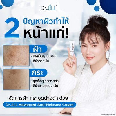 Anti-melasma cream for sensitive skin