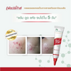 Spot treatment gel with Acne Magnet Formula