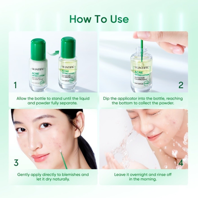 SKINTIFIC Acne Spot Treatment