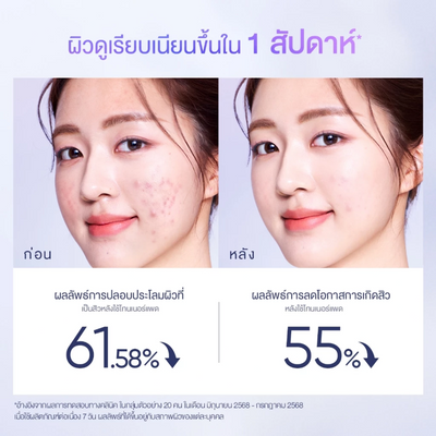 Exfoliating facial pads for pore purification