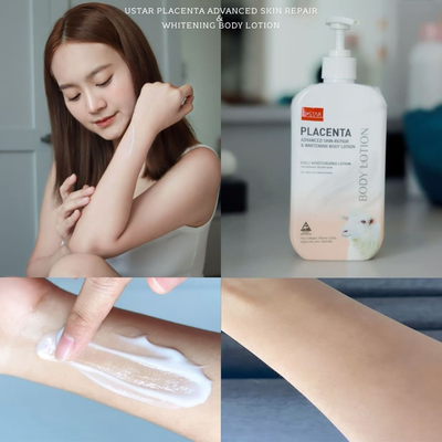 Ustar Placenta Vitamin C Lotion