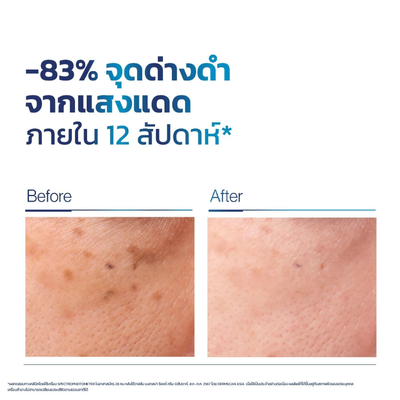 Vaseline Pro Derma 4% Glycoxome